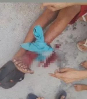 Criança atacada por jacaré em Arapiraca se recupera em casa