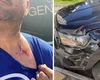 Professor foi agredido durante uma briga de trânsito em Maceió