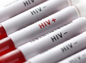 Fiocruz fabricará remédios contra HIV e hepatite C para ofertar no SUS