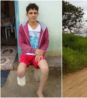 Servidor que amputou o próprio pé alegou que perdeu membro em sequestro
