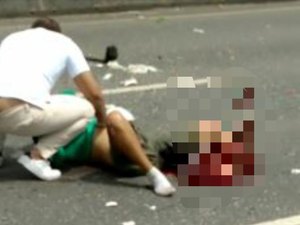 Entregador tem perna decepada em acidente na AL-110, em Arapiraca