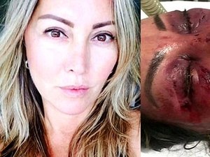 Mulher é espancada no Rio e jovem é preso em flagrante