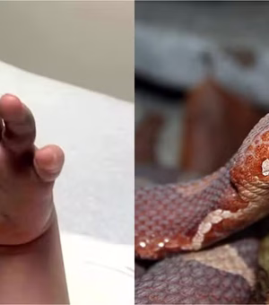 Menino de 4 anos é picado por cobra venenosa, e creche não aciona emergência: 'Achei que fosse uma farpa'