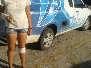 Jovem é atacada por Pit Bull no Centro de Girau do Ponciano