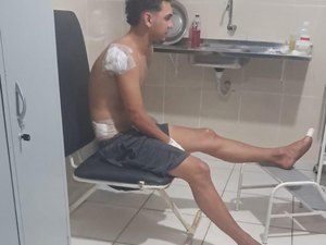 Jovem sofre acidente após passar em buraco na AL-101 Norte em Milagres