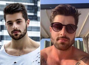 Saiba o que é a harmonização facial, processo que conquistou os famosos