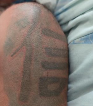 Hospital de Emergência do Agreste tenta localizar familiares de paciente sem identificação