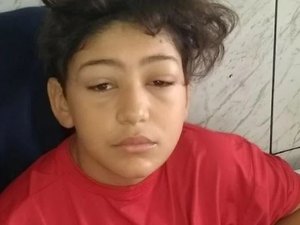 Mãe pede ajuda para custear tratamento do filho de 12 anos que perdeu 100% da visão por inflamação na córnea