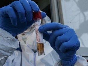 Teste em massa é a base para soluções à covid-19, diz especialista