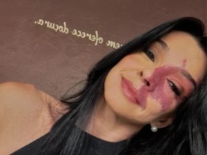 Empresária de Maceió morre em consequência de câncer cerebral