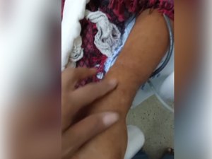 Família de paciente custodiado relata suposta negligência em atendimento no HEA, em Arapiraca