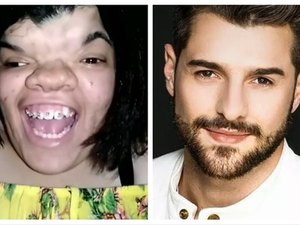 DJ Alok doa R$ 30 mil para jovem com deformação facial fazer cirurgia