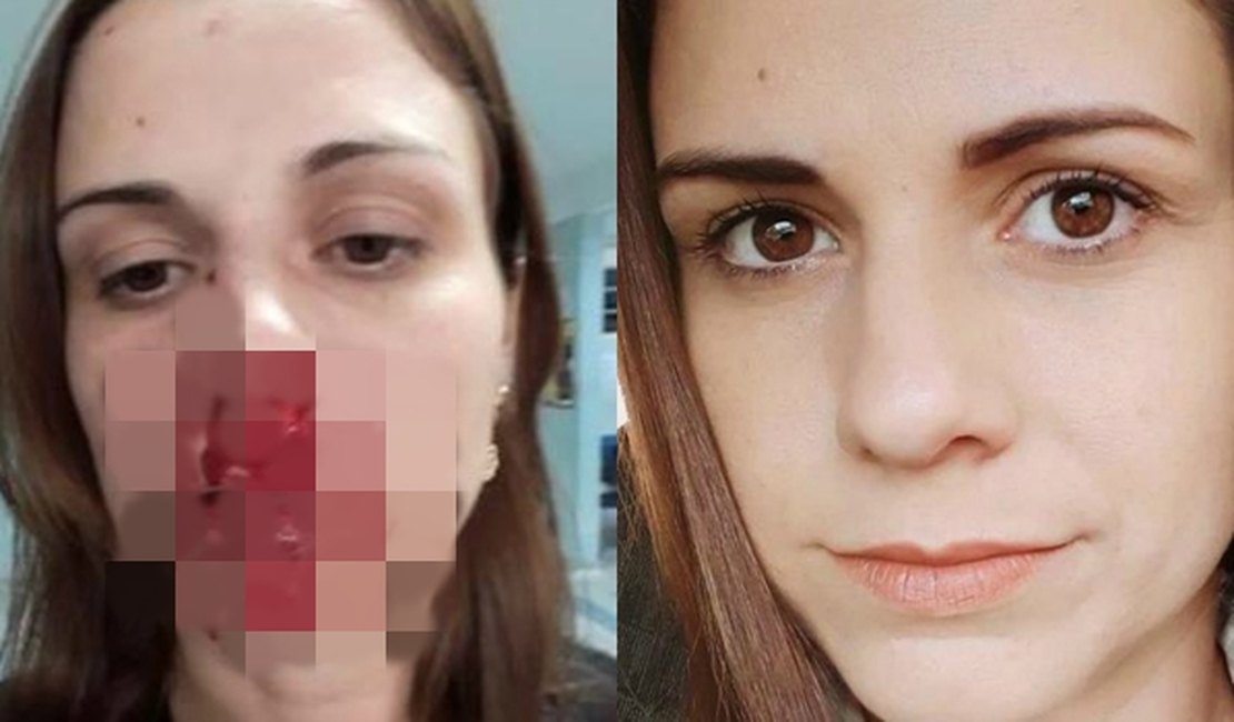 Mulher acusa ex-marido de agressão e posta foto com rosto ensanguentado