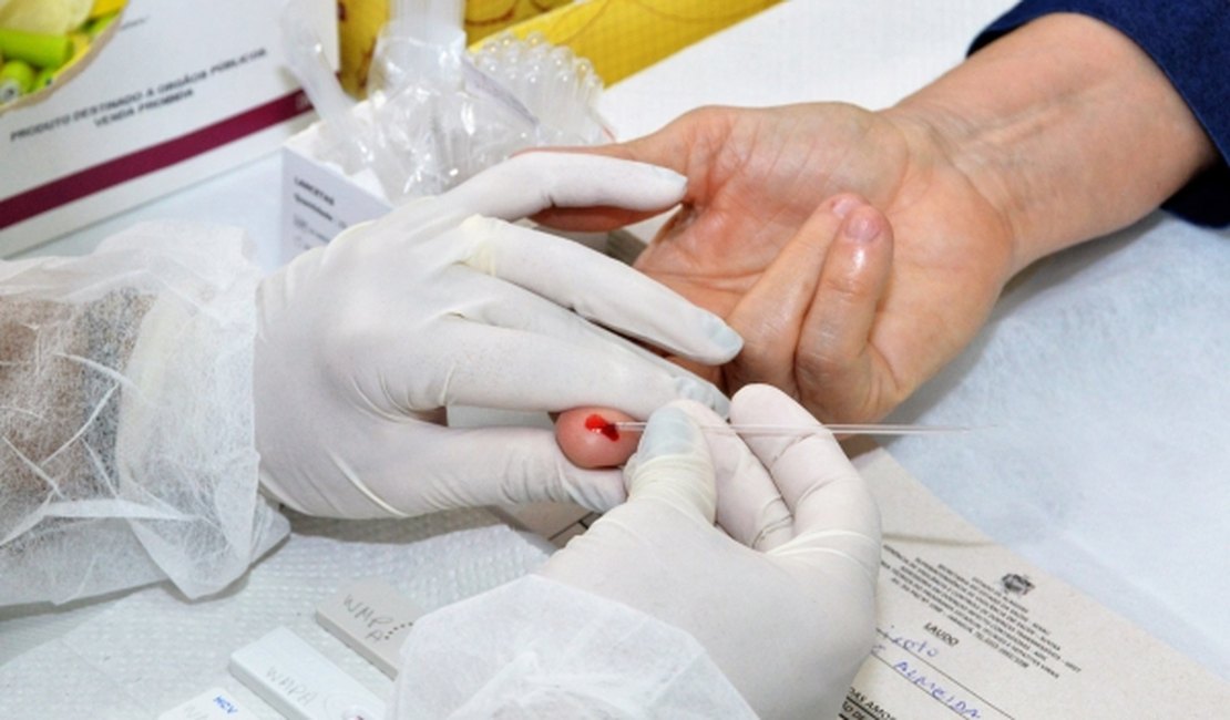 Ambulatório da Sesau atende pacientes em estágio inicial do HIV