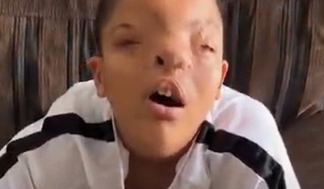 Jovem de 12 anos precisa de ajuda para realizar cirurgia em São Paulo