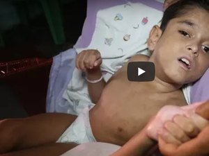 [Vídeo] Família pede ajuda para menino de nove anos com síndromes raras