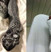 Mulher usa meia-calça de 'cobra', assusta o marido e vai parar no hospital 