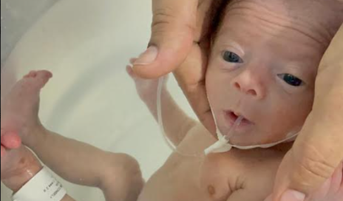 Semana da Amamentação: Hospital Regional de Arapiraca oferece banhos de ofurô para bebês