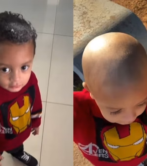 Criança usa creme depilatório na cabeça e perde o cabelo