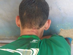 Homem é agredido por populares ao tentar assaltar jovem para comprar crack 