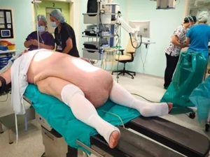 Tumor abdominal de 35 kg impede homem de urinar e choca médicos