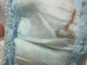 Mãe encontra rato morto dentro da fralda de bebê de um mês no Rio de Janeiro