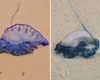 Jovem sofre queimaduras de caravelas no rosto, na Praia do Francês