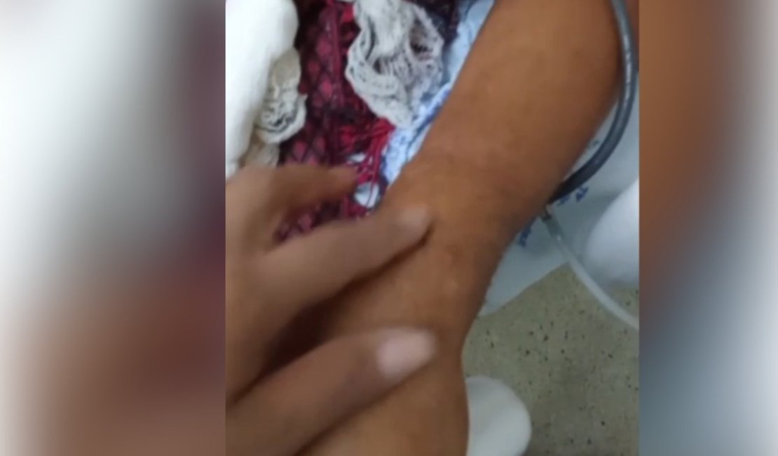 Família de paciente custodiado relata suposta negligência em atendimento no HEA, em Arapiraca