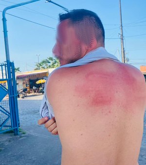 Seprev irá apurar suposta agressão de agentes do Ronda a filho de tenente