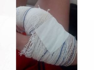 Mãe sofre tentativa de feminicídio com o filho no colo em Arapiraca