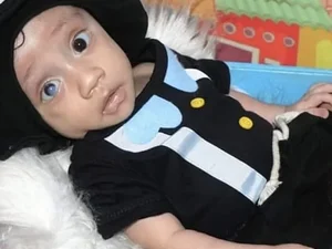 Bebê de sete meses diagnosticado com cardiopatia congênita precisa de ajuda para fazer três cirurgias