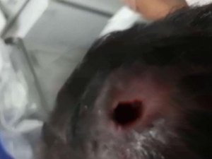 Criança com mais de 50 larvas na cabeça é internada