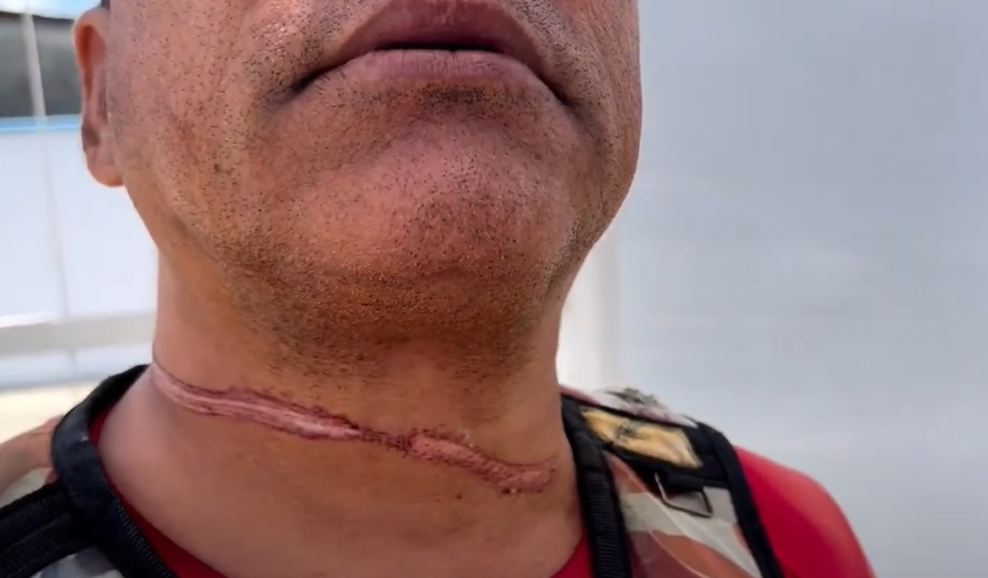 Mototaxista tem pescoço ferido por fio pendurado em poste