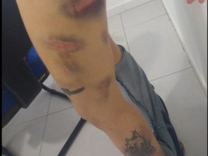 Homem é preso por torturar e fazer ex-namorada comer fezes