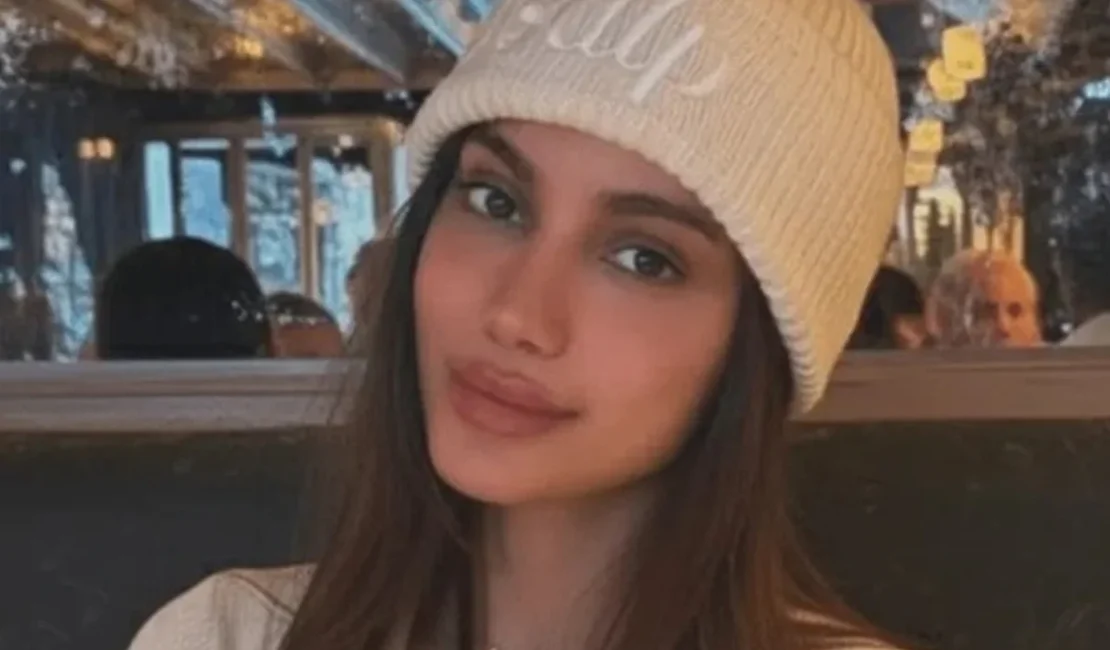 Anitta aparece com rosto diferente e web reage. Veja antes e depois