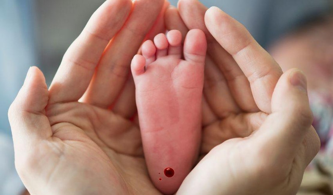 Teste do Pezinho: Triagem neonatal é realizada nas Unidades de Saúde de Maceió