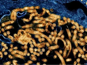 Surto: CDC da África confirma 395 casos de ebola e 106 mortes