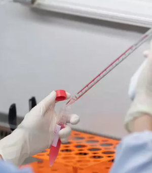 Vírus letal encontrado na Bolívia pode ser transmitido entre humanos, diz CDC