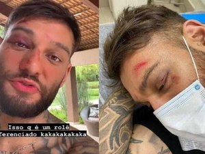 Lucas Lucco assusta fãs ao mostrar rosto desfigurado e dedo quebrado após acidente