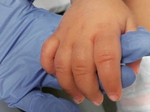 'Avassalador', diz médica que viu 3 crianças morrerem sem vacina