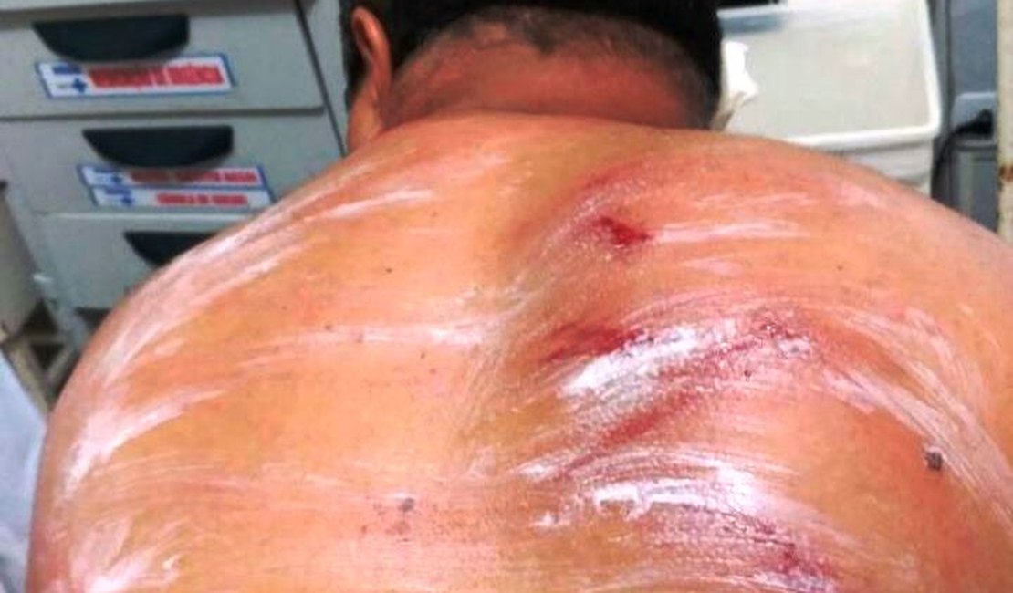 Radialista alagoano é agredido por  homens armados na porta de casa em Pernambuco