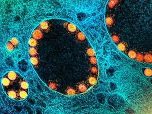 Casos de Covid-19 sobem em Alagoas e em outros 14 estados, aponta Boletim da Fiocruz