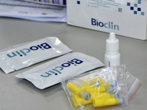 Sesau entrega testes rápidos de hanseníase para 38 municípios com casos confirmados da doença