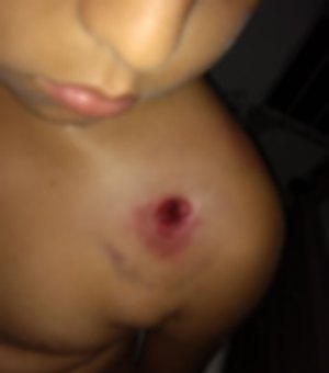 Após abordagem policial a usuários de drogas, menino de nove anos é atingido por bala de borracha