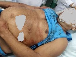 Crime brutal: vigilante é assassinado a facadas em Japaratinga