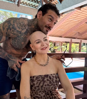 Mãe de Lucas Lucco fala sobre mensagens recebidas após diagnóstico de alopecia areata: 'Não é sobre estética'