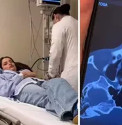 Juliette Freire fratura o nariz em acidente doméstico: 'Está meio torto'