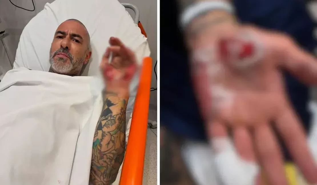 Henrique Fogaça diz que teve aliança roubada em hospital após acidente