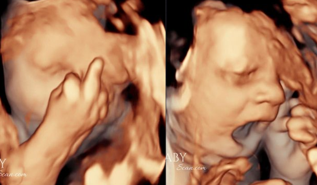Bebê choca pais ao mostrar 'dedo do meio' e bocejar em ultrassom