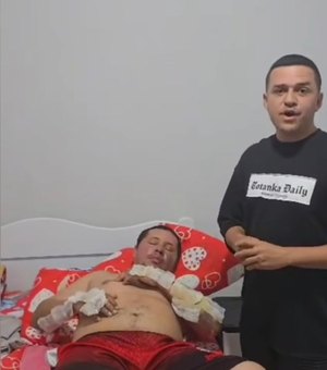 Motorista de app que teve corpo incendiado pede ajuda para tratamento